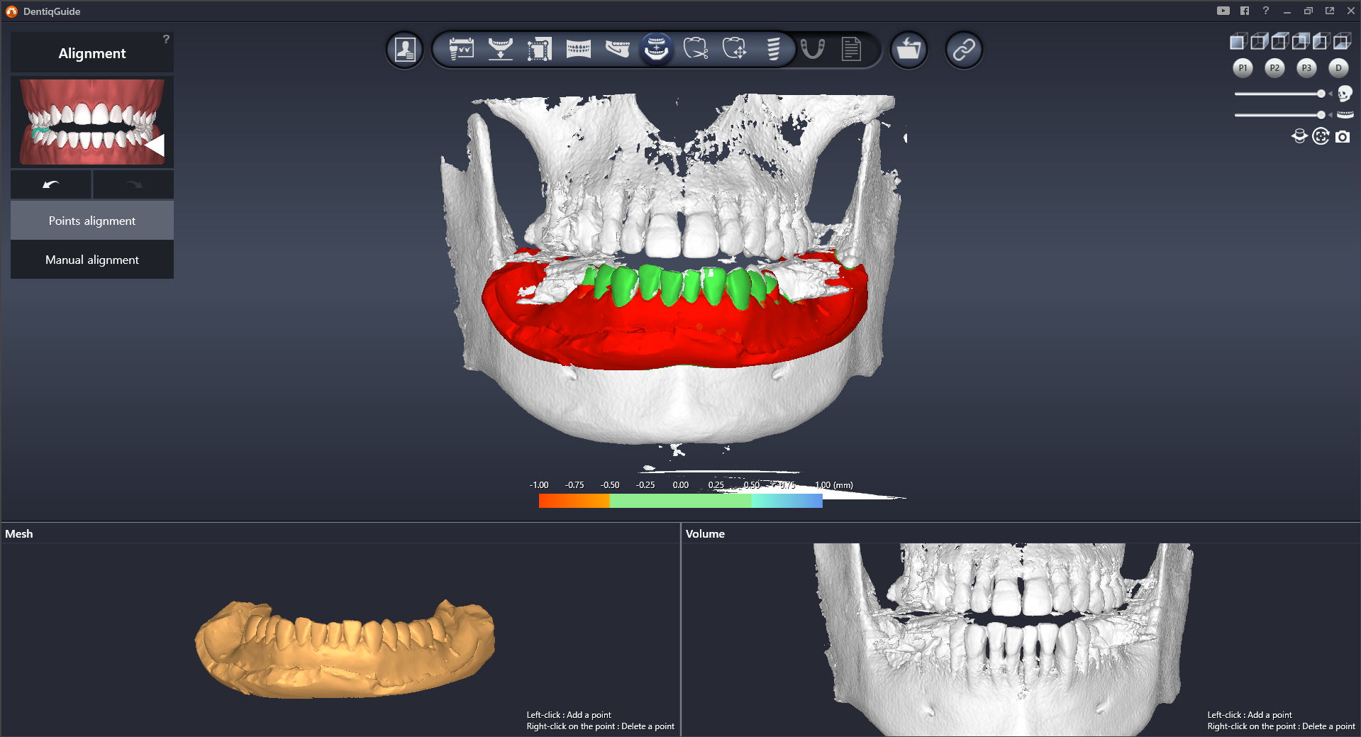 CT-Scan Data Alignment