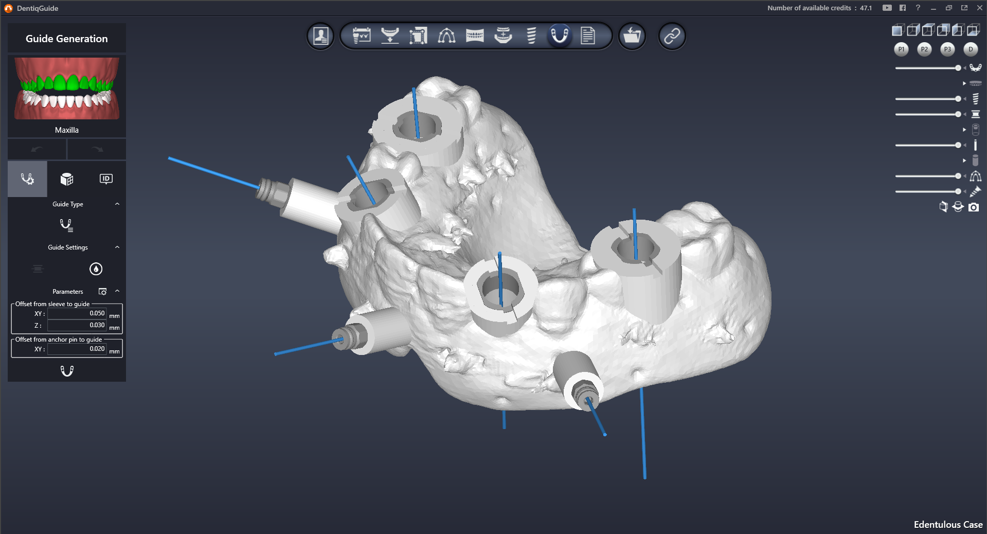 DentiqGuide Interface 2
